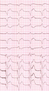 ECGPM